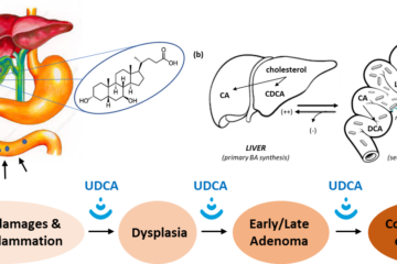 Ursodeoxycholic acid and cancer: From chemoprevention to chemotherapy